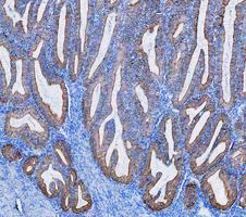 a01421 krt8 primary antibodies ihc testing 7_1