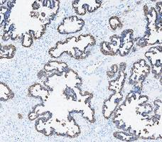 a01421 krt8 primary antibodies ihc testing 8_1