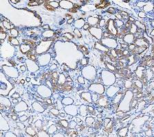 a01421 krt8 primary antibodies ihc testing 9_1