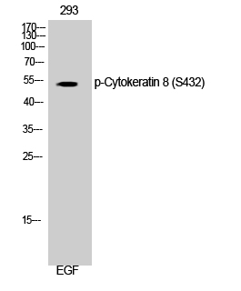 Western Blot analysis of 293 cells using Phospho-Cytokeratin 8 (S432) Polyclonal Antibody diluted at 1:1000