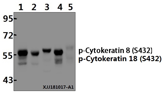 Western blot (WB) analysis of Cytokeratin 8 (phospho-S432) polyclonal antibody at 1:500 dilution
Lane1:PC3 whole cell lysate(20µg)
Lane2:MCF-7 whole cell lysate(20µg)
Lane3:Hela whole cell lysate(20µg)
Lane4:A549 whole cell lysate(20µg)
Lane5:The Lung tissue lysate of Mouse(20µg)