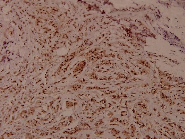 a01422t60 wnk1 primary antiboties ihc testing 2