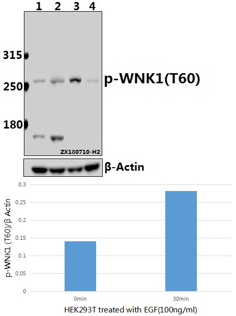 a01422t60 wnk1 primary antiboties wb testing 1