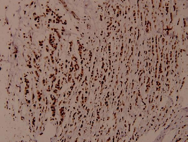 a01422y52 wnk1 primary antiboties ihc testing 2