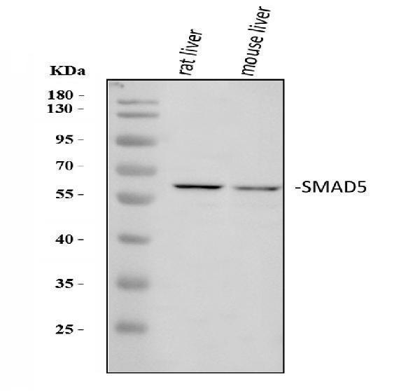  Western blot analysis of SMAD5 using anti-SMAD5 antibody (A01423)