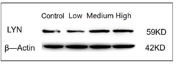 Western blot analysis of Lyn using anti-Lyn antibody (A01424-2)