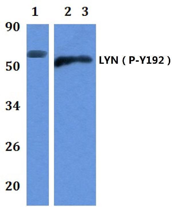 Western blot (WB) analysis of p-LYN (Y192) polyclonal antibody at 1:500 dilution
Lane1:MCF-7 whole cell lysate
Lane2:The Brain tissue lysate of Mouse
Lane3:The Brain tissue lysate of Rat