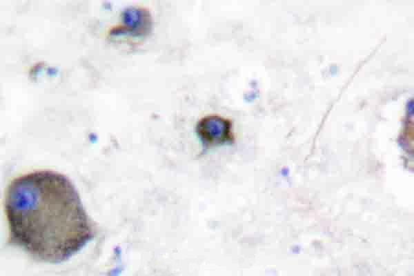 Immunohistochemistry (IHC) analyzes of p-Lyn (Y508) pAb in paraffin-embedded human brain tissue