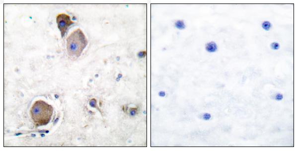 a01424y508 lyn primary antibodies ihc testing 5
