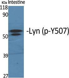 Western Blot analysis of various cells using Phospho-Lyn (Y508) Polyclonal Antibody diluted at 1:1000