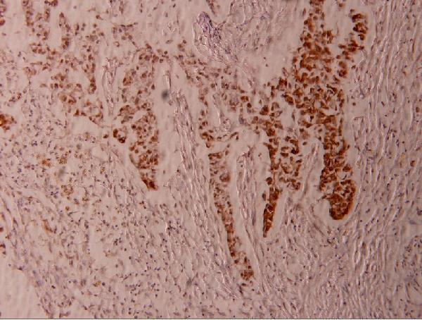 a01426s383 1 elk1 primary antiboties ihc testing 2
