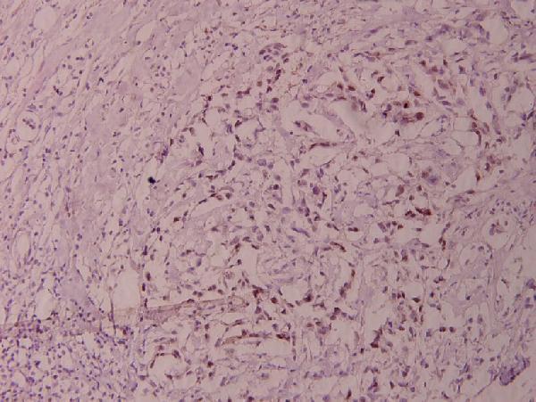 a01426s383 elk1 primary antiboties ihc testing 2