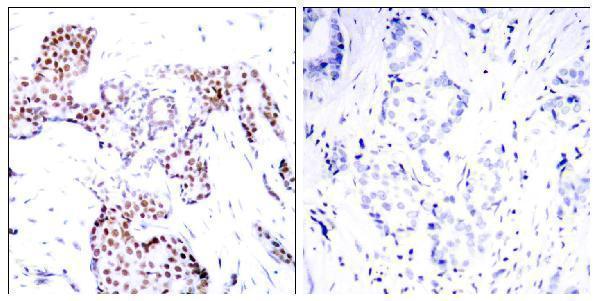 a01426s389 1 elk1 primary antibodies ihc testing 1