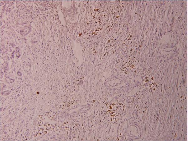 a01426s389 elk1 primary antiboties ihc testing 2