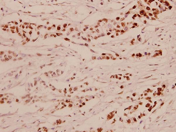 a01426s411 elk1 primary antiboties ihc testing 2