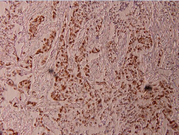 a01426t417 elk1 primary antiboties ihc testing 2