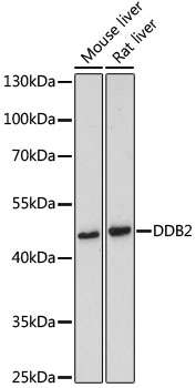 Western blot analysis of extracts of various cell lines, using DDB2 antibody  at 1:500 dilution