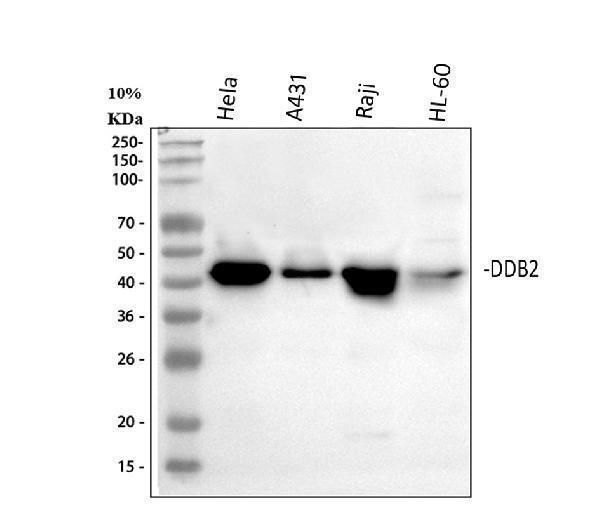  Western blot analysis of DDB2 using anti-DDB2 antibody (A01430-2)