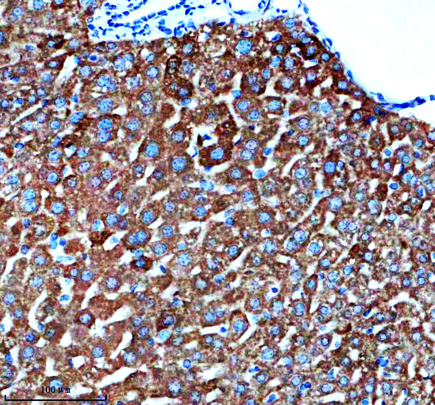 IHC analysis of LSS using anti-LSS antibody (A01431-1)