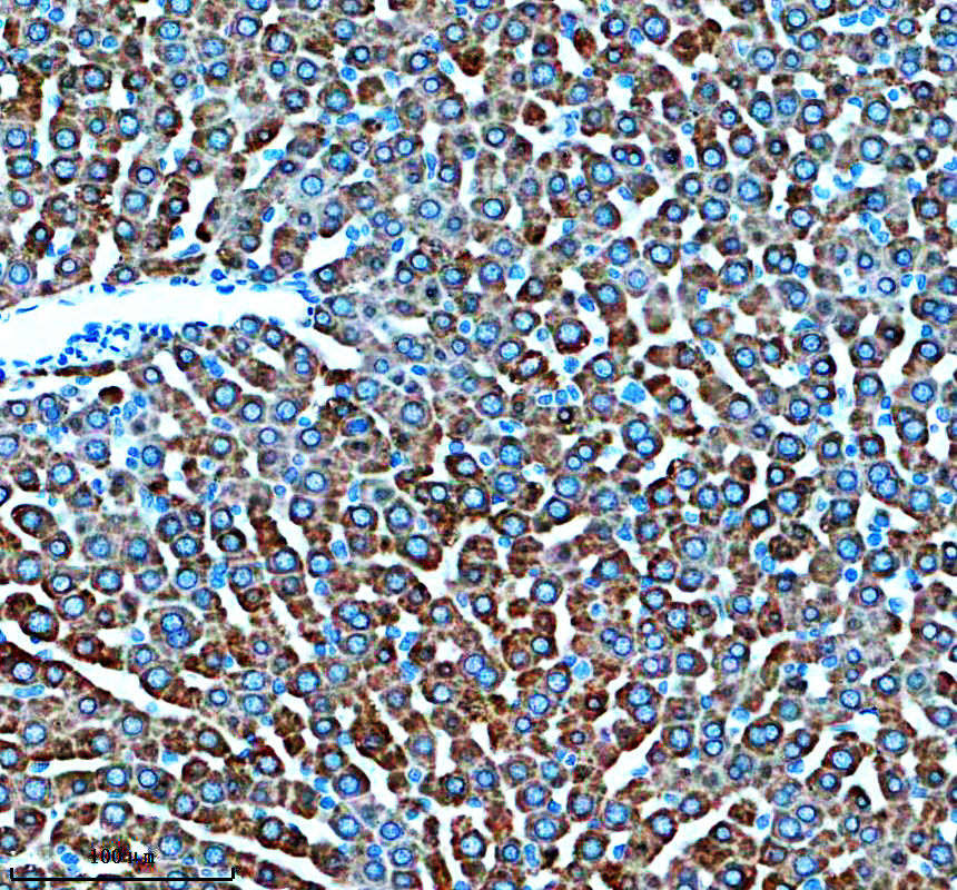 IHC analysis of LSS using anti-LSS antibody (A01431-1)