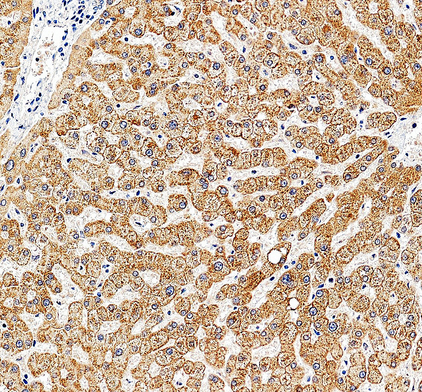 a01431 1 lss primary antibodies ihc testing 3