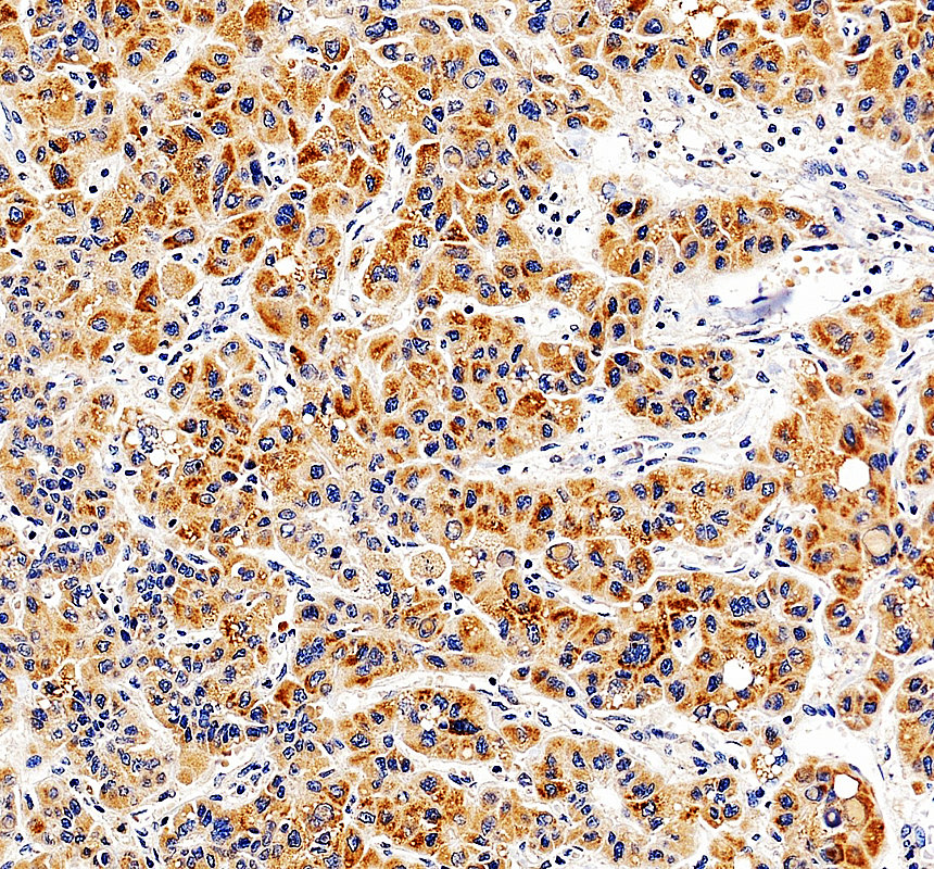 a01431 1 lss primary antibodies ihc testing 4