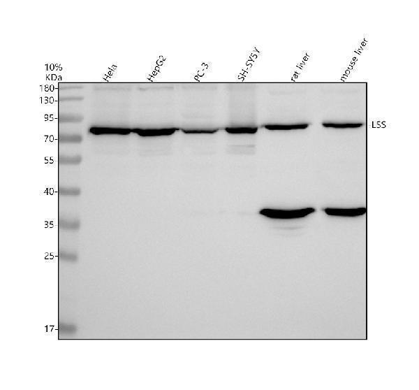 Western blot analysis of LSS using anti-LSS antibody (A01431-1)