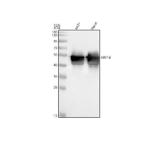 Western blot analysis of KRT14 using anti-KRT14 antibody (A01432-3)