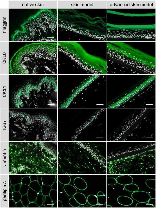 Immunofluorescence staining of filaggrin, CK10, CK14, Ki67, vimentin, perilipin A, and DAPI of native skin and skin models