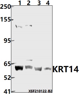 a01432s5 krt14 primary antiboties wb testing 1