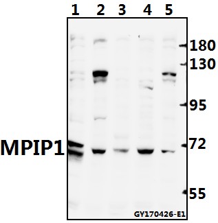 Western blot (WB) analysis of Cdc25A polyclonal antibody at 1:500 dilution
Lane1:CT26 whole cell lysate(40ug)
Lane2:PC12 whole cell lysate(40ug)
Lane3:A549 whole cell lysate(40ug)
Lane4:L02 whole cell lysate(40ug)
Lane5:Hela whole cell lysate(40ug)