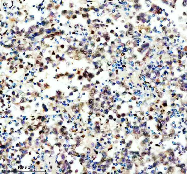 IHC analysis of CDC25A using anti-CDC25A antibody (A01433-3)