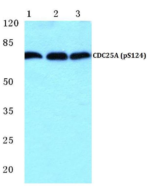 Western blot (WB) analysis of p-CDC25A (S124) polyclonal antibody at 1:500 dilution
Lane1:HEK293T cell lysate
Lane2:Mouse spleen tissue lysate
Lane3:Rat liver tissue lysate
