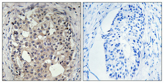 Immunohistochemistry validation of CDC25A using Anti-Phospho-Cdc25A (S178) Antibody (A01433S178)
