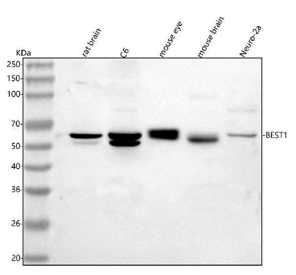 Western blot analysis of Bestrophin-1/Best1 Antibody using anti-Bestrophin-1/Best1 Antibody antibody (A01434-2)