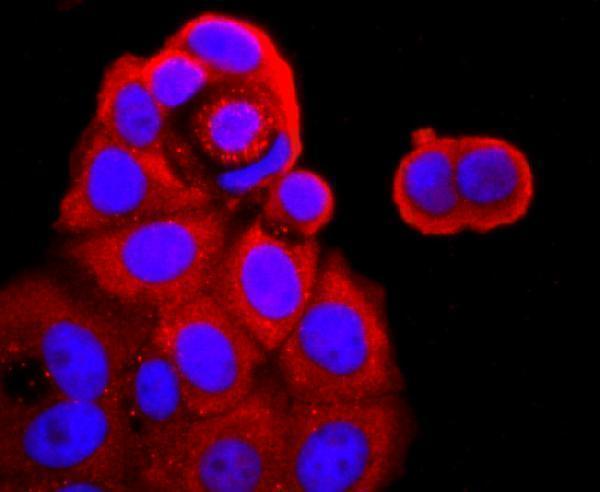 a01437 tnfrsf1b primary antiboties icc testing 2