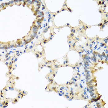 Immunohistochemistry of paraffin-embedded rat brain using CCL11 antibody at dilution of 1:100 (40x lens)