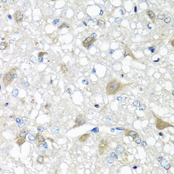 Immunohistochemistry of paraffin-embedded human stomach using CCL11 antibody at dilution of 1:100 (40x lens)