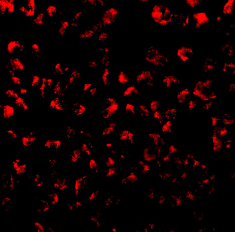 Immunofluorescence of Eotaxin in 293 cells with Eotaxin antibody at 10 μg/mL