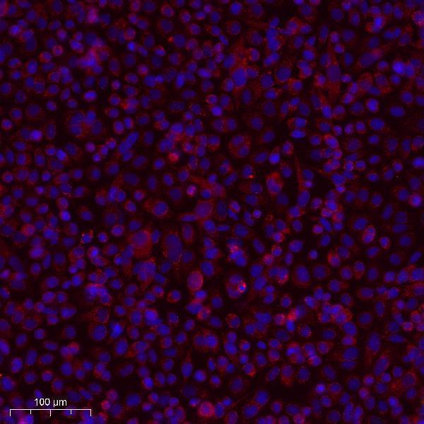 a01439 c1qbp primary antibodies if testing 1