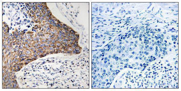 Immunohistochemistry analysis of paraffin-embedded human tonsil tissue, using C1QBP Antibody