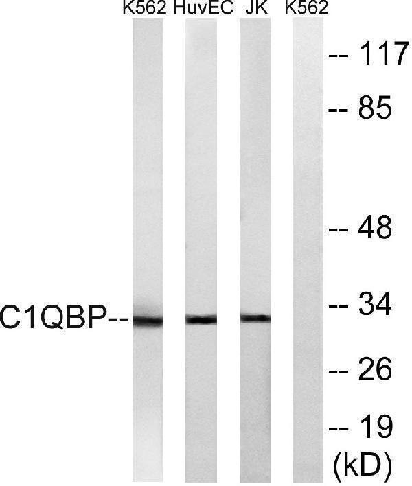 Western blot analysis of lysates from Jurkat, HUVEC, and K562 cells, using C1QBP Antibody