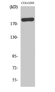 Western blotting validation for Anti-BCL-6 corepressor BCoR Antibody A01440