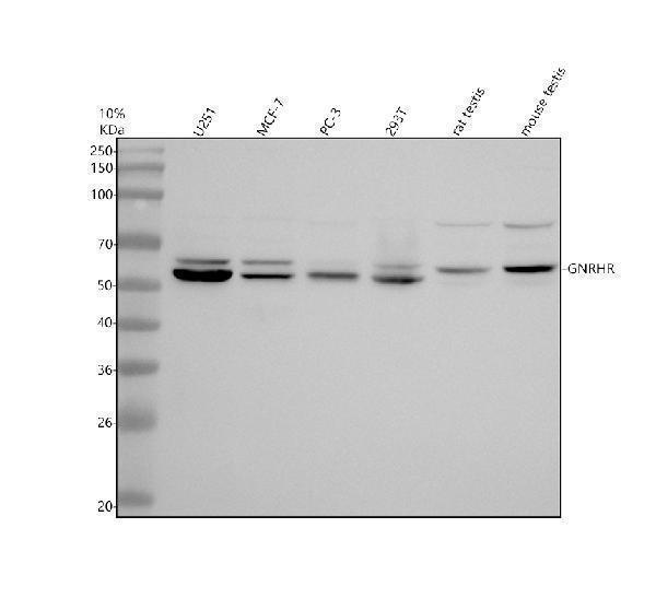 Western blot analysis of GNRHR using anti-GNRHR antibody (A01442-2)