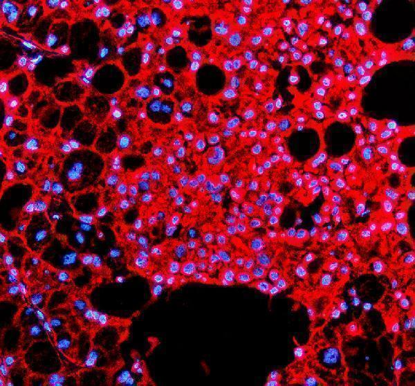 a01448 1 ihh primary antibodies if testing 1