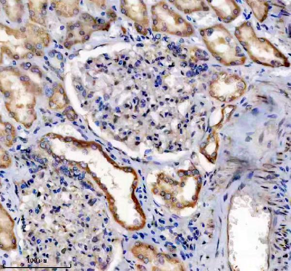 IHC analysis of IHH using anti-IHH antibody (A01448-1)