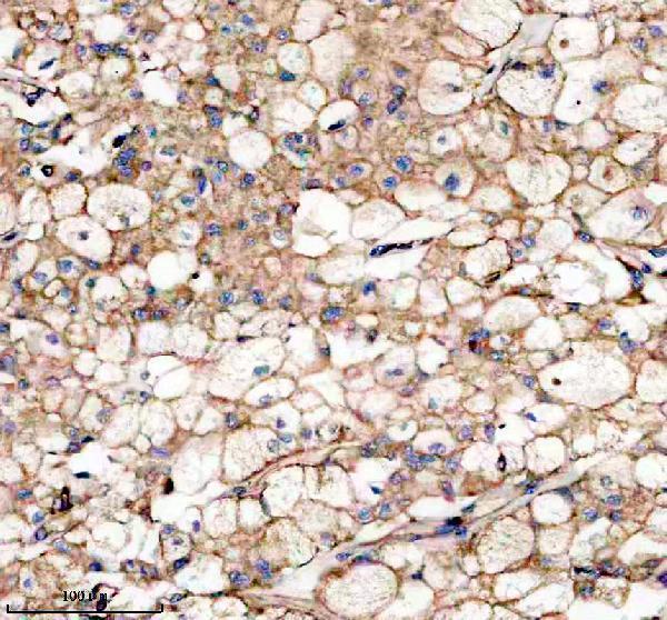 IHC analysis of IHH using anti-IHH antibody (A01448-1)