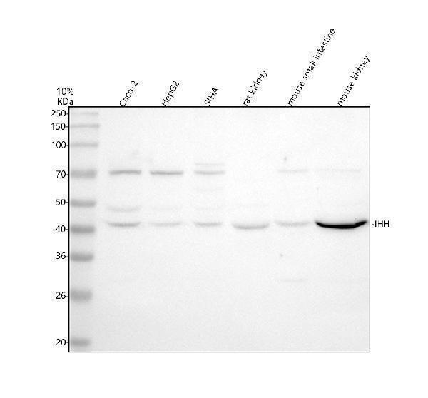 Western blot analysis of IHH using anti-IHH antibody (A01448-1)