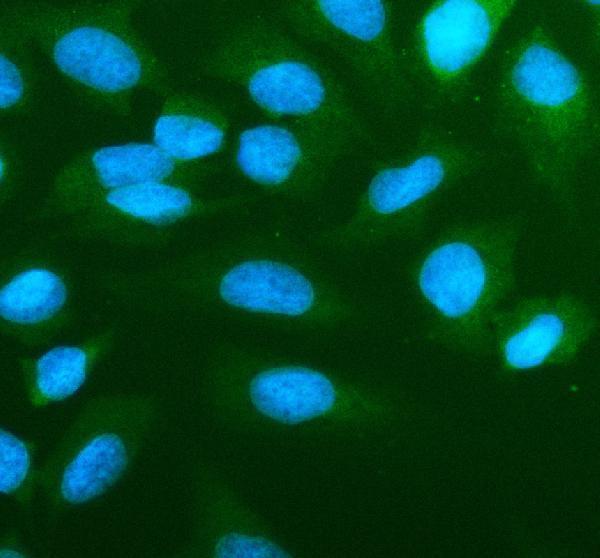 a01451 1 anxa1 primary antibodies if testing 11