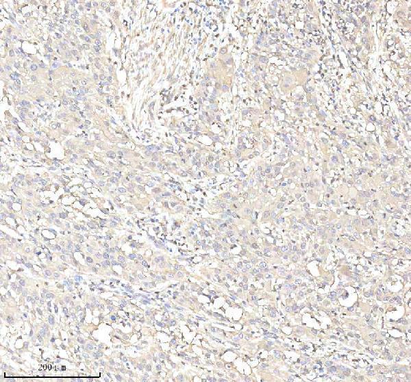  IHC analysis of Annexin A1/ANXA1 using anti-Annexin A1/ANXA1 antibody (A01451-1)